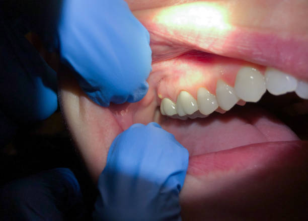 Best 24-Hour Emergency Dentist in Pumpkin Center, NC