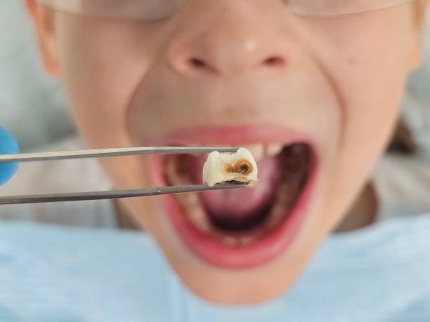 Best Emergency Dental Extractions in Pumpkin Center, NC