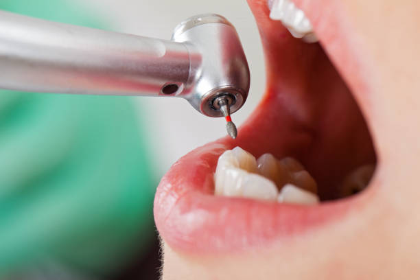 Best Pediatric Emergency Dentist in Pumpkin Center, NC